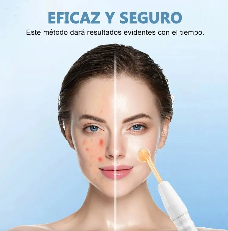 SkinGlow™  Dispositivo de Alta Frecuencia Facial Profesional