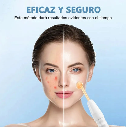 SkinGlow™  Dispositivo de Alta Frecuencia Facial Profesional