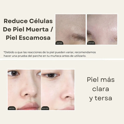 Mixsoon™ Esencia Exfoliante e Hidratante para una piel suave y luminosa
