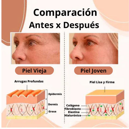 Derol Lift™ Bálsamo Reafirmante y Revitalizante de Piel