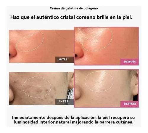 Medicube™ La Crema Viral con Colágeno que Transforma tu Piel en Glass Skin