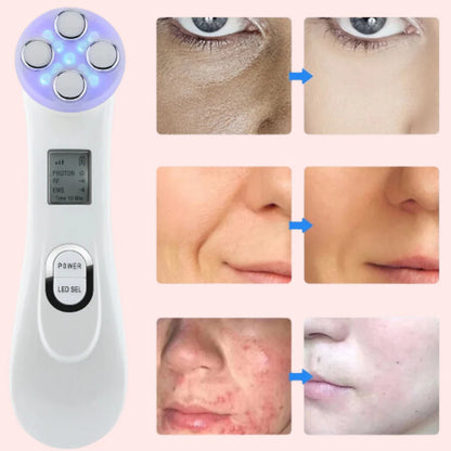 LumiDerma™ Rejuvenece tu piel sin agujas ni filtros desde casa